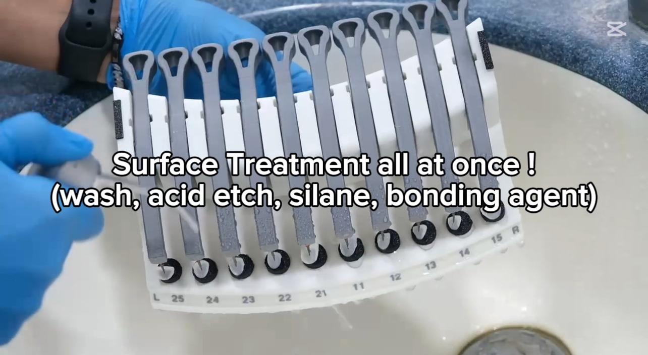 Load video: Full Mouth Porcelain veneers Surface Treatment sequence Video with Magsmile